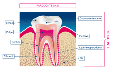 parodontale